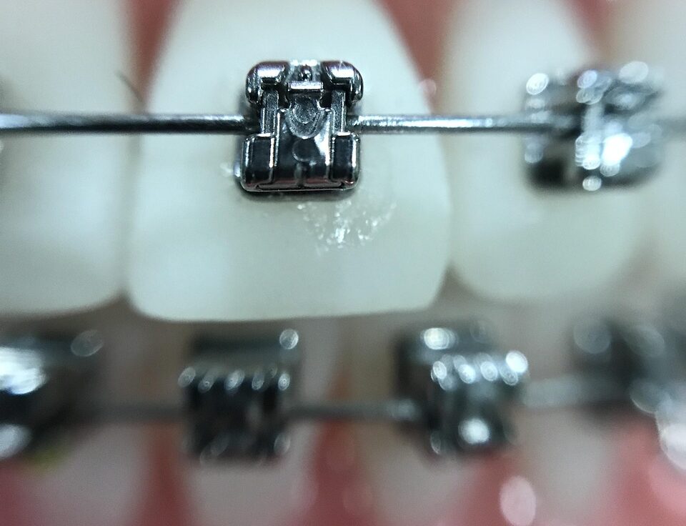 zoom, orthodontics, iphone, orthodontics, orthodontics, orthodontics, orthodontics, orthodontics