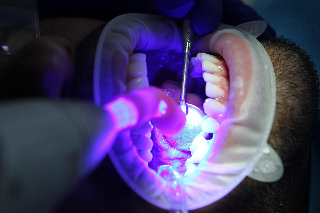 dentist, oral health, dental health, oral hygiene, dental hygiene, teeth cleaning, teeth whitening, teeth whitening, teeth whitening, teeth whitening, teeth whitening, teeth whitening