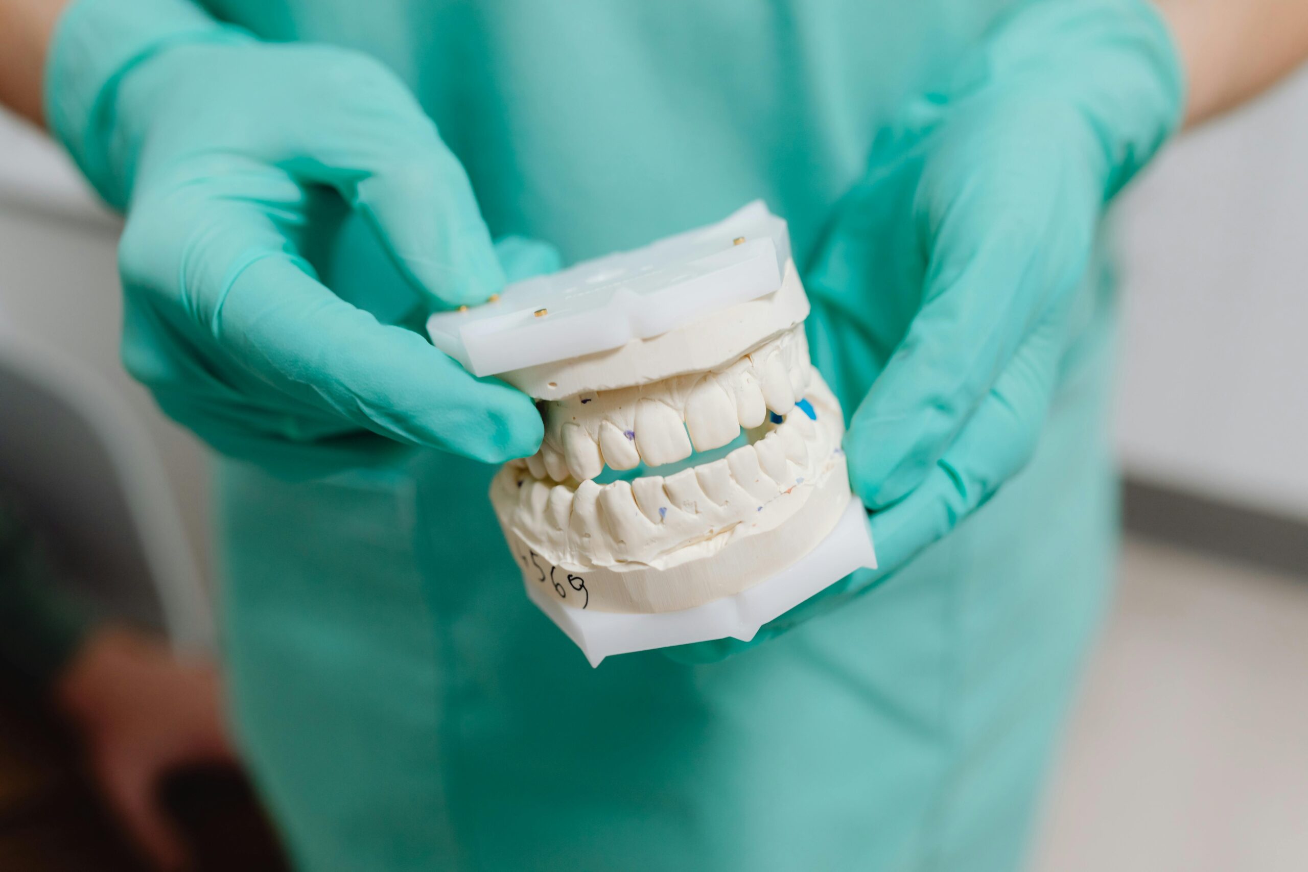 Close-up view of a dental model held by a professional with green gloves in a clinic setting.
